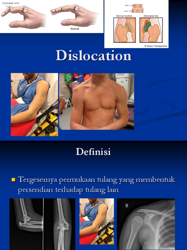 DISLOKASI Anatomical Terms Of Motion Hip