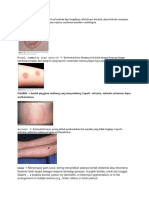 Morfologi dan Distribusi Lesi Kulit dalam
