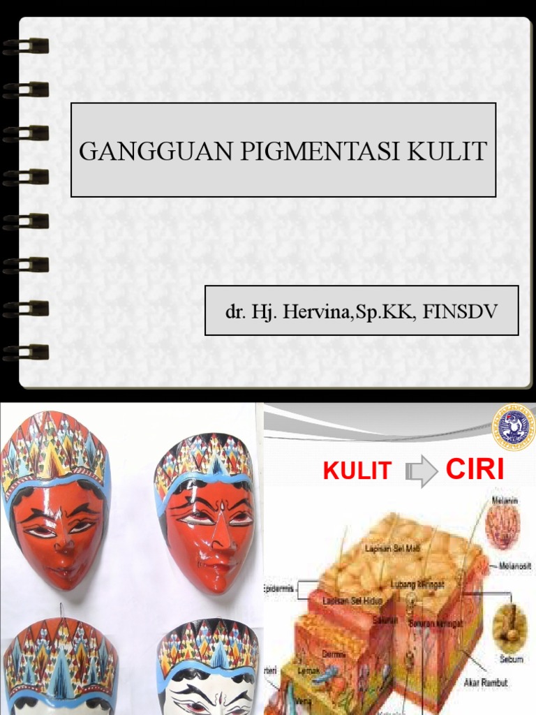 GANGGUAN PIGMENTASI  KULIT  GANGGUAN PIGMENTASI  KULIT