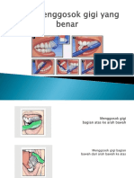 Cara Menggosok Gigi Yang Benar