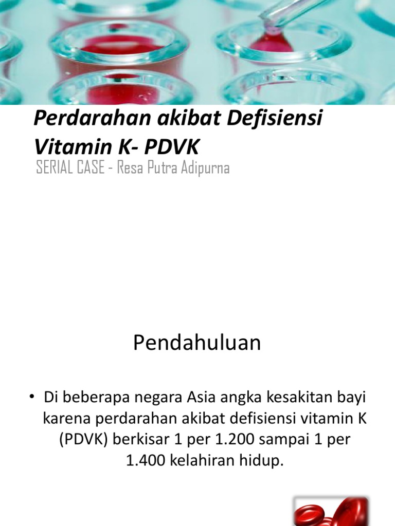 Perdarahan Akibat Defisiensi Vitamin K PDVK PDF
