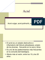 Acné