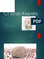 CT Scan Kepala: Akbar Neurosurgeon