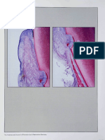 Rasperini 2000 - CT graft and Emdogain.pdf