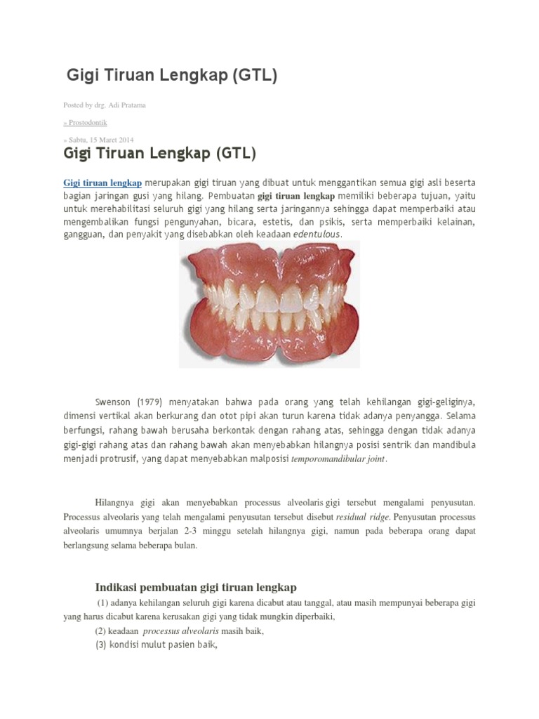 Gigi Tiruan Lengkap | PDF