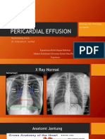 YOSI - Pericardial Effusion.pptx