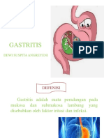 Ppt Gastritis