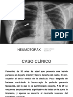 Caso Clinico Neumotorax
