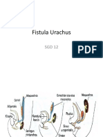 Fistula Urachus