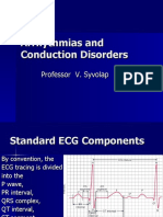 Abnomalites of ECG