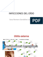 infecciones del oido