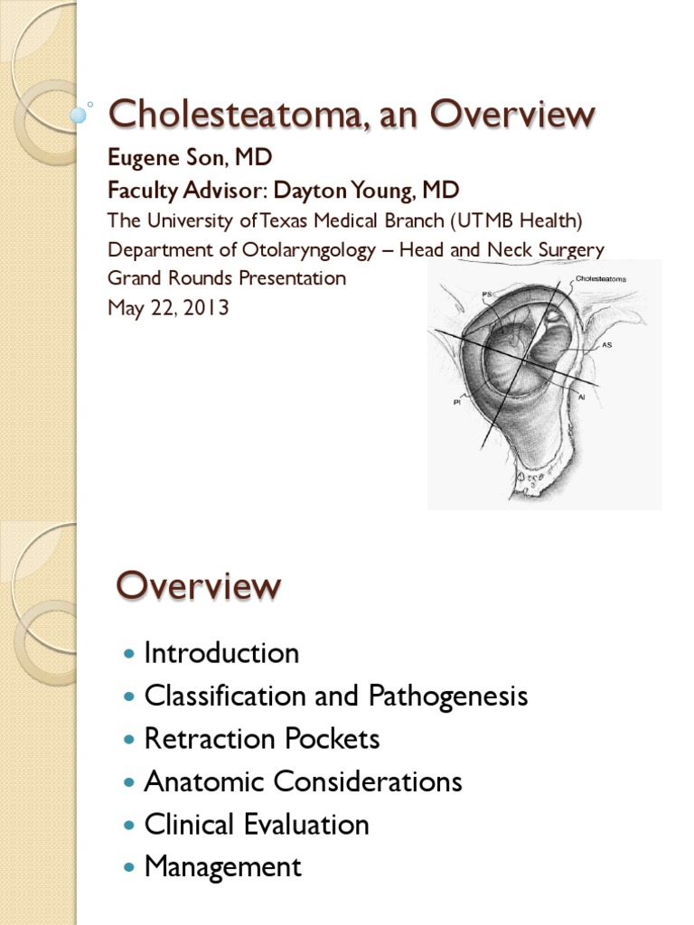 Cholesteatoma Pic 2013 05 Ear Epithelium