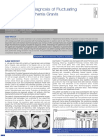 Challenging Diagnosis of Fluctuating Dyspnea MG