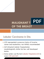 Malignant Tumors of The Breast