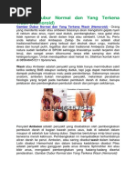 Download Gambar Dubur Normal Dan Yang Terkena Wasir by wawan wijanarko SN369041104 doc pdf