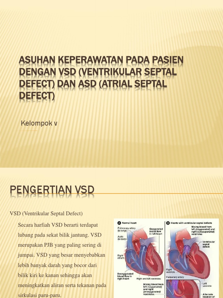 Asuhan Keperawatan VSD dan ASD pada Anak | PDF