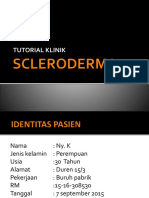 Skleroderma 