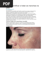 Como identificar e tratar as manchas na pele.docx