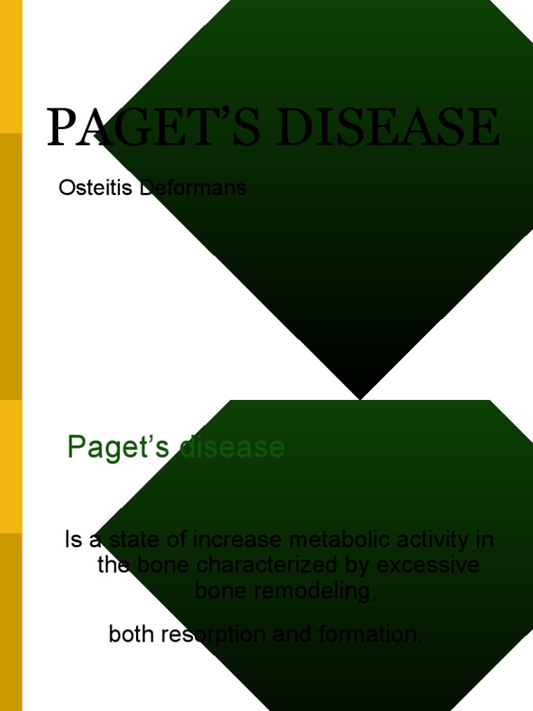 Overview of Paget's Disease Pathophysiology | PDF | Bone | Diseases And ...