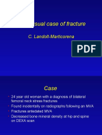 Unusual Case of Bilateral Femoral Stress Fractures