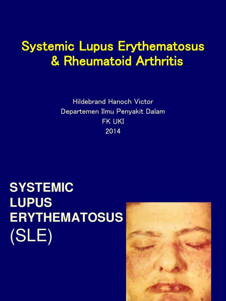 Systemic Lupus Erythematosus & Rheumatoid Arthritis Hildebrand Hanoch