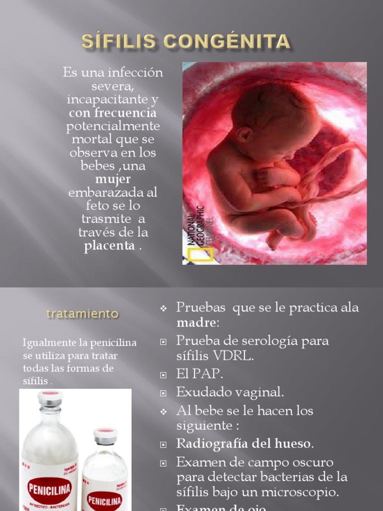Sífilis Congénita | PDF