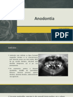 Anodontia, MD 4
