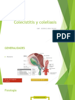 Colecistitis y Colelitiasis