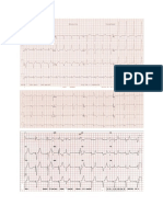 Gambar EKG