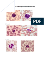 Gambaran Leukosit Pada Hapusan Darah Tepi