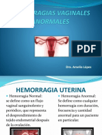 Hemorragias Vaginales Anormales Amelia