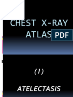 18.Chest Atlas