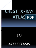 18.chest Atlas
