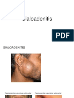 SIALOADENITIS