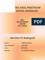 Interpretasi Hasil Praktikum Skillab Dental Radiologi