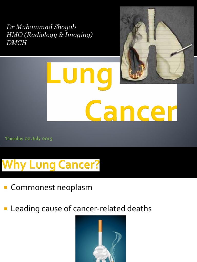 Lung Cancer Types and Detection Insights | PDF | Carcinoma | Adenocarcinoma