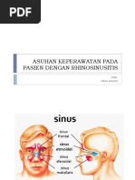 Asuhan Keperawatan Pada Pasien Dengan Rhinosinusitis: Oleh: Hana Ariyani