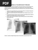 Radioanatomi Thorax dalam Rontgen | PDF