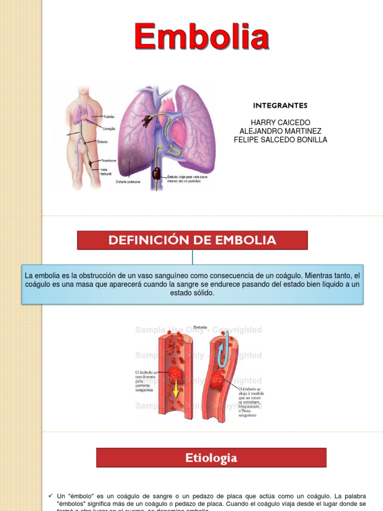 Definición y Tipos de Embolia | PDF | Embolia | Trombo