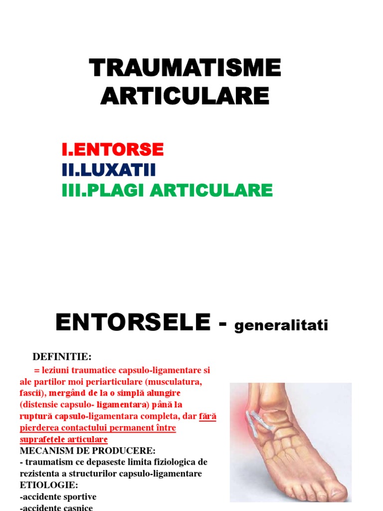 entorse articulare