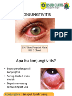 Konjungtivitis