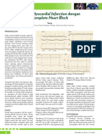 13_189Inferior Myocardial Infarction dengan Complete Heart Block.pdf