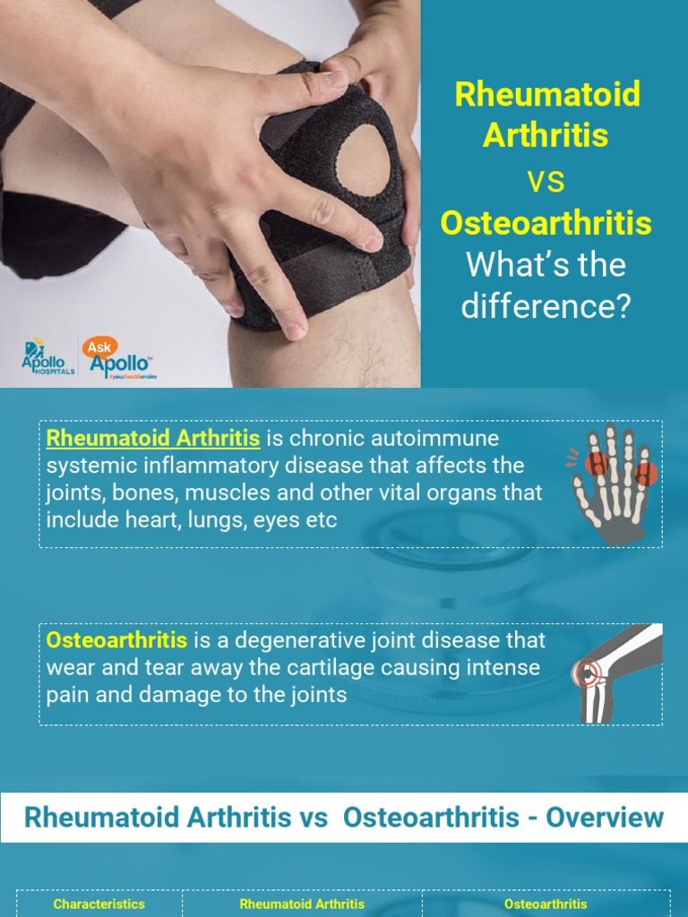 Rheumatoid Arthritis vs Osteoarthritis Arthritis Osteoarthritis