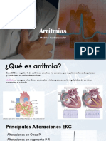 Arritmias