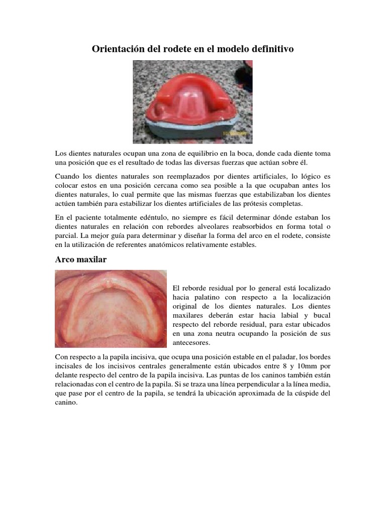 Orientación de rodetes en prótesis total | PDF | Dentadura postiza | Diente