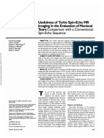 Usefulness of Turbo Spin-Echo MR Imaging in The Evaluation of Meniscal Tears - Comparison With A Conventional Spin-Echo Sequence