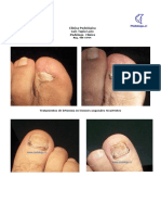 TratamientosPodologicos PDF