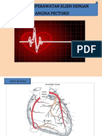 Askep Angina Pectoris