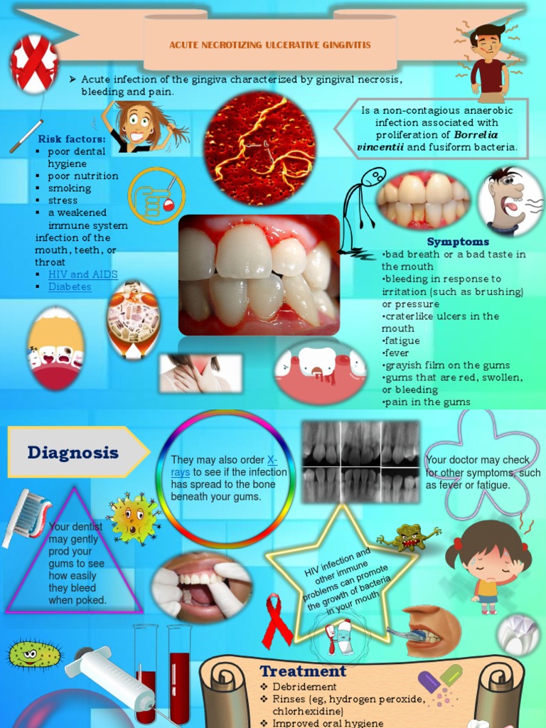Acute Necrotizing Ulcerative Gingivitis Risk Factors PDF Dentistry Diseases And Disorders