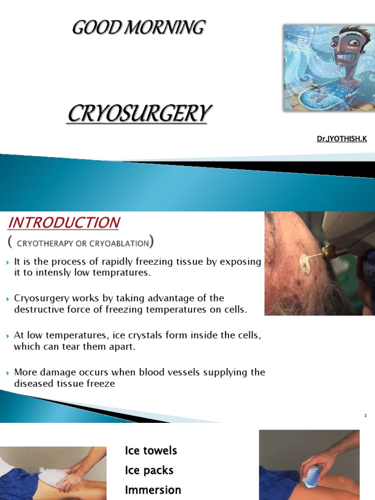 Cryosurgery1111 170308052751 | PDF | Medicine | Clinical Medicine